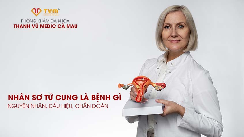 Nhân xơ tử cung là bệnh gì? Nguyên nhân, dấu hiệu, chẩn đoán